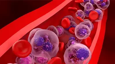 Cemmp-Noticia-GSK anuncia resultados positivos de belantamab mafodotina en combinación para tratar el mieloma múltiple